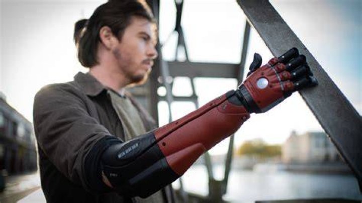 bionic arm