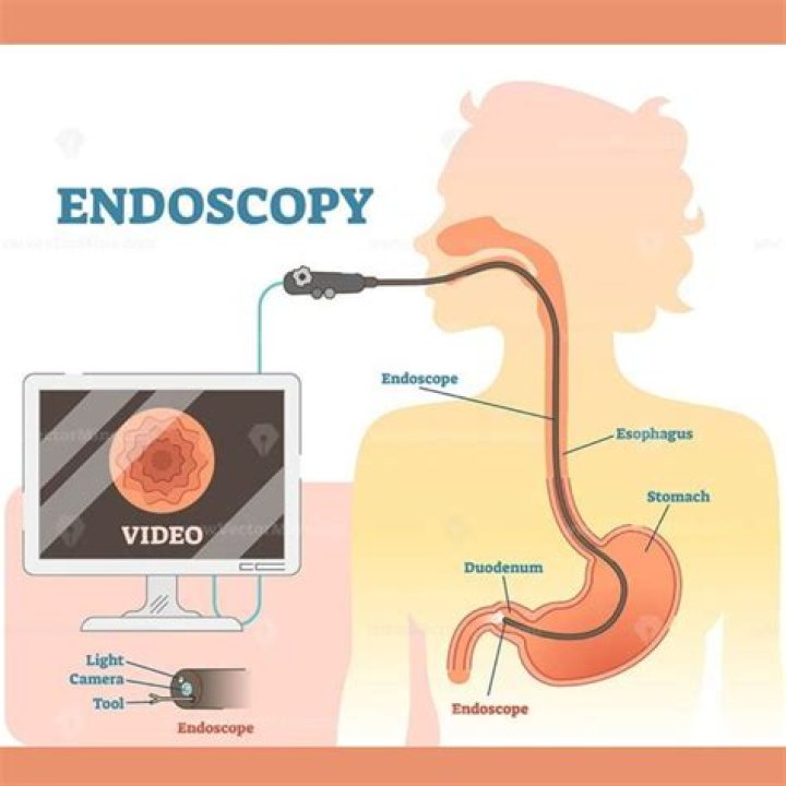 Endoscopy technician - How To Discuss